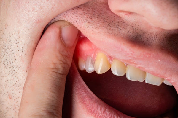 Layanan Periodonsia(1)